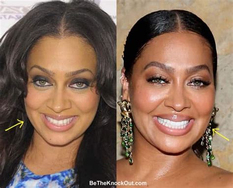 lala anthony|la la anthony before surgery.